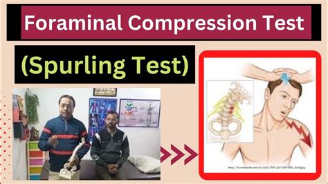 jack sons compression test|foraminal compression test positive.